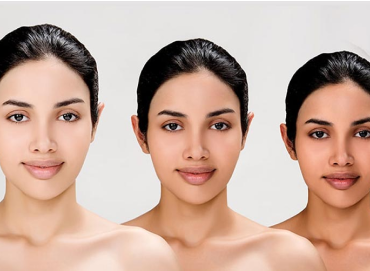 Best Skin Care Clinic in Vijaynagar