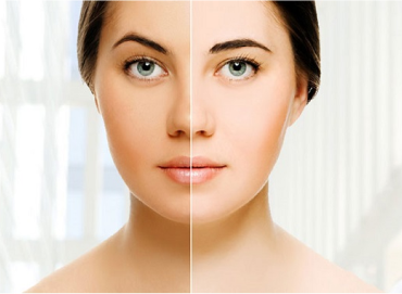 Best Skin Care Clinic in Vijaynagar