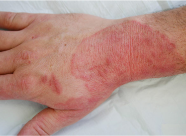 Best Skin Care Clinic in Vijaynagar