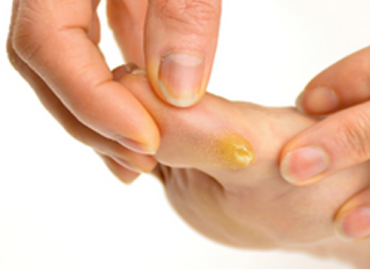 Best Skin Care Clinic in Vijaynagar
