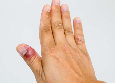 Best Skin Care Clinic in Vijaynagar