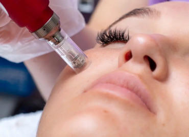 Best Skin Care Clinic in Vijaynagar