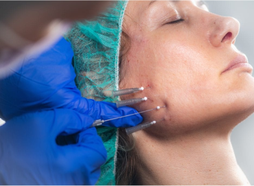 Best Skin Care Clinic in Vijaynagar